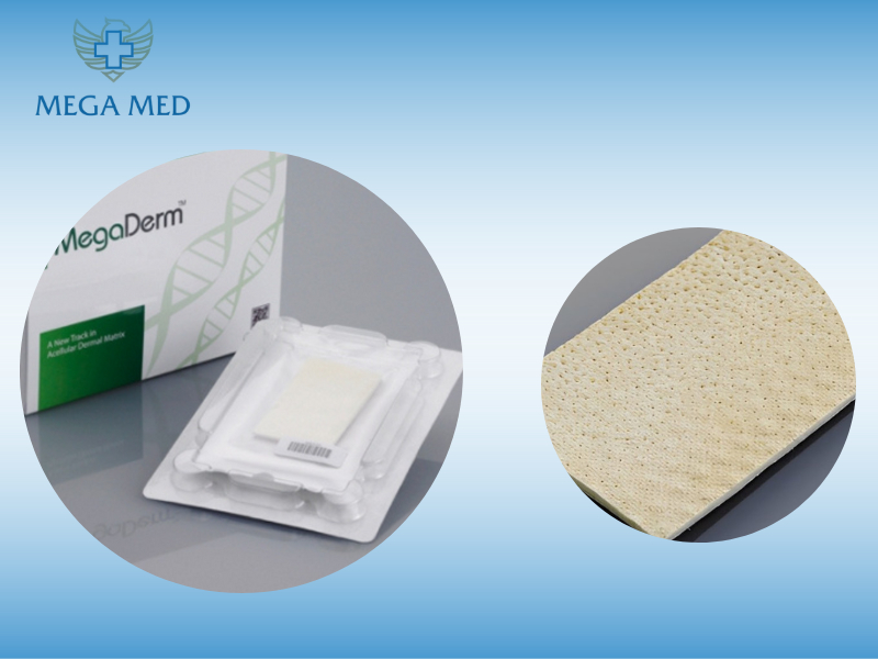 tăng kích cỡ cậu nhỏ phẫu thuật